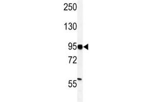 Western blot analysis of HIF-1 alpha antibody and MDA-MB231 lysate