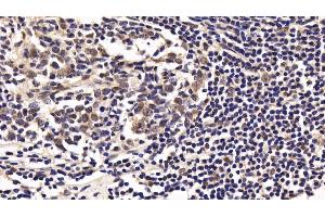 Immunohistochemistry (IHC) image for anti-Interleukin 10 Receptor, alpha (IL10RA) (AA 132-235) antibody (ABIN7433870)