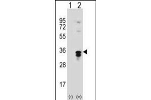 Western blot analysis of T1 (arrow) using rabbit polyclonal T1 Antibody  (ABIN389117 and ABIN2839303). (PPT1 抗体  (C-Term))