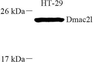 Western blot analysis of Dmac2l (ABIN7073751) at dilution of 1: 250 (Distal Membrane Arm Assembly Complex 2 L Homeolog (DMAC2.L) 抗体)