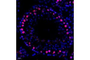Immunofluorescent analysis of paraffin embedded mouse testis using MED8 (ABIN7074582) at dilution of 1: 600 (MED8 抗体)