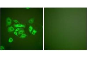Immunofluorescence analysis of A549 cells, using Keratin 10 Antibody. (Keratin 10 抗体  (AA 136-185))