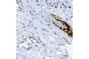 IHC analysis of Integrin beta 3/ITGB3 using anti-Integrin beta 3/ITGB3 antibody (ABIN7601139).