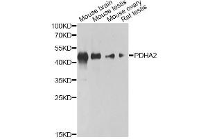 Western blot analysis of extracts of various cell lines, using PDHA2 antibody (ABIN6293728) at 1:1000 dilution. (PDHA2 抗体)