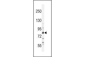 Z Antibody (N-term) (ABIN654759 and ABIN2844443) western blot analysis in WiDr cell line lysates (35 μg/lane). (ZNF180 抗体  (N-Term))