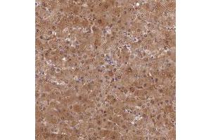 Immunohistochemical staining of human liver with SLC25A41 polyclonal antibody  shows moderate cytoplasmic and nuclear positivity in hepatocytes at 1:50-1:200 dilution. (SLC25A41 抗体)