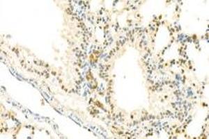 Immunohistochemistry analysis of paraffin-embedded mouse lung using,IOP2 (ABIN7074883) at dilution of 1: 2000 (NARF 抗体)