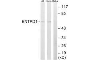 Western Blotting (WB) image for anti-Ectonucleoside Triphosphate diphosphohydrolase 1 (ENTPD1) (AA 351-400) antibody (ABIN2890296) (CD39 抗体  (AA 351-400))