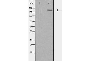Western blot analysis of 53BP1 expression in HUVEC cells. (TP53BP1 抗体)