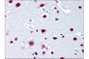 Immunohistochemistry (IHC) image for anti-Scaffold Attachment Factor B2 (SAFB2) (AA 345-357) antibody (ABIN302304) (SAFB2 抗体  (AA 345-357))