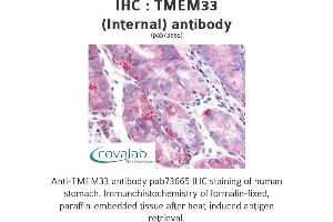 Image no. 2 for anti-Transmembrane Protein 33 (TMEM33) (Internal Region) antibody (ABIN1740155) (TMEM33 抗体  (Internal Region))