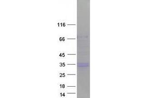 Western Blotting (WB) image for CD99 (CD99) (Transcript Variant 1) protein (Myc-DYKDDDDK Tag) (ABIN2713822)