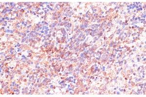 Immunohistochemistry of paraffin-embedded Rat spleen using CDC20 Polyclonal Antibody at dilution of 1:100 (40x lens). (CDC20 抗体)