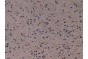 IHC-P analysis of Mouse Brain Tissue, with DAB staining. (NPPC 抗体  (AA 30-126))