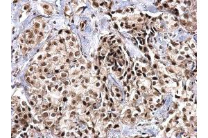 Immunohistochemistry (IHC) image for anti-Small Nuclear Ribonucleoprotein D2 Polypeptide 16.5kDa (SNRPD2) antibody (ABIN2855196)