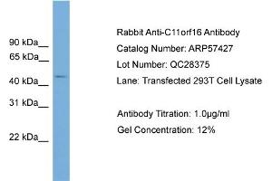 WB Suggested Anti-C11orf16  Antibody Titration: 0. (C11ORF16 抗体  (Middle Region))