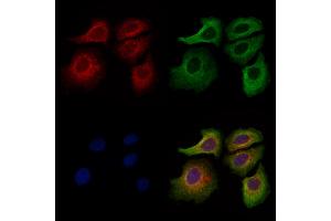 ABIN7094708 and ABIN7098759 staining Hela cells by IF/ICC. (ACTR1A 抗体  (Internal Region))
