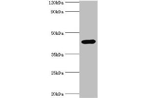 Western blot All lanes: Interleukin-1 receptor type 2 antibody at 3 μg/mL + Mouse kidney tissue Secondary Goat polyclonal to rabbit IgG at 1/10000 dilution Predicted band size: 46, 34 kDa Observed band size: 46 kDa (IL1R2 抗体  (AA 20-320))