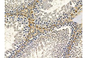 ABIN7097176 and ABIN7101244 at 1/100 staining rat testis tissue by IHC-P.