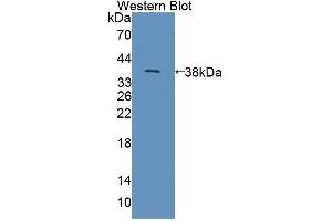 Western blot analysis of the recombinant protein. (NKp44/NCR2 抗体  (AA 22-120))