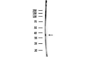 anti-Tumor Suppressor Candidate 3 (TUSC3) (Internal Region) antibody