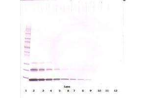 Image no. 1 for anti-Chemokine (C-C Motif) Ligand 16 (CCL16) antibody (ABIN465913) (CCL16 抗体)