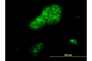 Immunofluorescence of monoclonal antibody to RHOA on A-431 cell. (RHOA 抗体  (AA 1-193))