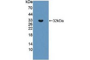 Western blot analysis of recombinant Human ABCC8. (ABCC8 抗体  (AA 679-929))
