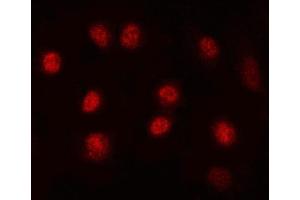 IF analysis of MAX using anti-MAX antibody (ABIN5692891). (MAX 抗体  (AA 30-106))