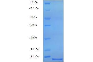 SDS-PAGE (SDS) image for Serum Amyloid A (SAA) (AA 1-90), (full length) protein (His tag) (ABIN5713808)
