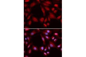 Immunofluorescence (IF) image for anti-Proteasome (Prosome, Macropain) 26S Subunit, Non-ATPase, 7 (PSMD7) antibody (ABIN1876544) (PSMD7 抗体)