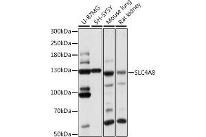 Western Blotting (WB) image for anti-Solute Carrier Family 4, Sodium Bicarbonate Cotransporter, Member 8 (SLC4A8) (AA 1-90) antibody (ABIN7270460)
