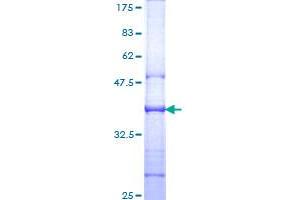 CD130/gp130 Protein (AA 23-122) (GST tag)