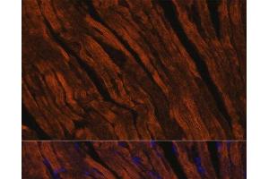 Immunofluorescence analysis of Mouse heart using MYH6 Polyclonal Antibody at dilution of 1:100. (MYH6 抗体)