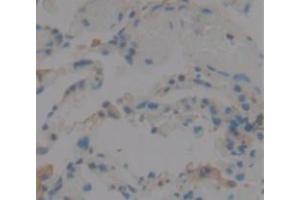 IHC-P analysis of Human Tissue, with DAB staining. (IL1F9 抗体  (AA 1-162))