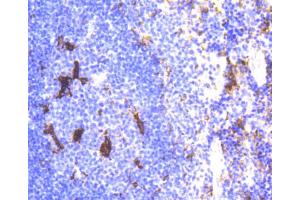Immunohistochemistry of paraffin-embedded mouse spleen using LYZ antibody.
