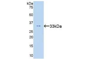Detection of Recombinant STAT6, Human using Polyclonal Antibody to Signal Transducer And Activator Of Transcription 6 (STAT6)