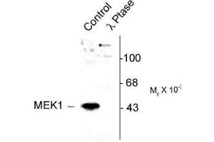 Image no. 2 for anti-Mitogen-Activated Protein Kinase Kinase 1 (MAP2K1) (pThr386) antibody (ABIN221148) (MEK1 抗体  (pThr386))