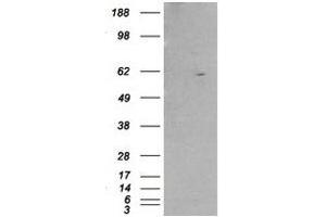 Image no. 1 for anti-Retinoid X Receptor, beta (RXRB) (Internal Region) antibody (ABIN374478) (Retinoid X Receptor beta 抗体  (Internal Region))