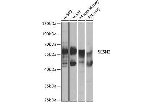 Western blot analysis of extracts of various cell lines, using SESN2 antibody (ABIN6128761, ABIN6147624, ABIN6147626 and ABIN6223421) at 1:1000 dilution. (Sestrin 2 抗体  (AA 211-480))