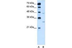 WB Suggested Anti-SLC36A3 Antibody Titration:  5. (SLC36A3 抗体  (N-Term))