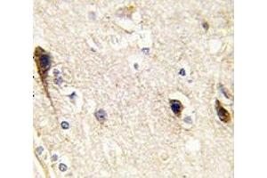 Immunohistochemistry (IHC) image for anti-Phosphatidylinositol-4-Phosphate 5-Kinase, Type I, beta (PIP5K1B) (AA 1-30) antibody (ABIN3032218)