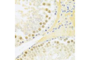 Immunohistochemistry of paraffin-embedded rat testis using RFC4 Antibody (ABIN5973195) at dilution of 1/100 (40x lens). (RFC4 抗体)