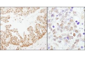 Immunohistochemistry (IHC) image for anti-Cleavage Stimulation Factor, 3' Pre-RNA, Subunit 2, 64kDa (CSTF2) (AA 527-577) antibody (ABIN7453681)