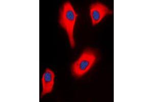 Immunofluorescent analysis of Glycerol Kinase 2 staining in HeLa cells. (GK2 抗体  (Center))