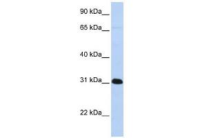 PADI4 antibody used at 1 ug/ml to detect target protein.