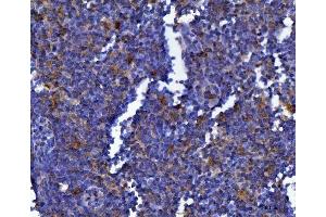 IHC analysis of MSF/SEPTIN9 using anti-MSF/SEPTIN9 antibody (ABIN7600104). (Septin 9 抗体  (AA 15-282))