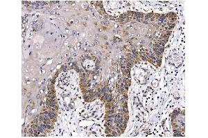 IHC analysis of PFKFB2 using anti-PFKFB2 antibody (ABIN7601627). (PFKFB2 抗体  (AA 4-505))