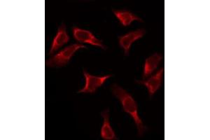 ABIN6272417 staining HeLa by IF/ICC. (RPS2 抗体  (C-Term))