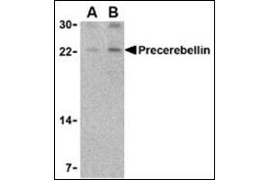Western blot analysis of precerebellin in mouse cerebellum lysate with this product at (A) 2 and (B) 4 μg/ml. (CBLN1 抗体  (Center))
